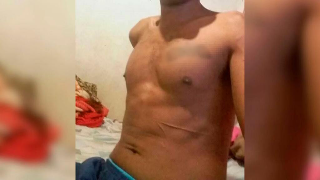 Adolescente mata o próprio pai com facada onde vítima havia tatuado o nome do filho, no Paraná