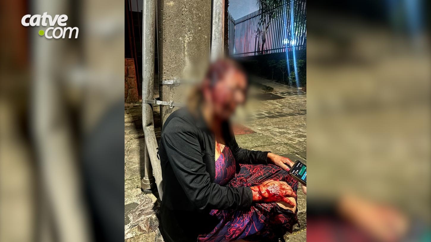 Recepcionista de hotel é agredida por hóspede no Paraná